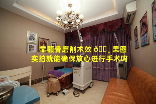 靠颧骨磨削术效 🌸 果图实拍就能确保放心进行手术吗